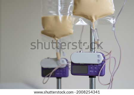 Couple of feeding pump medical device purple color to supplement nutrition liquid food to tube enteral feeding fluid set bag with clamp hanging on stand. Royalty-Free Stock Photo #2008254341
