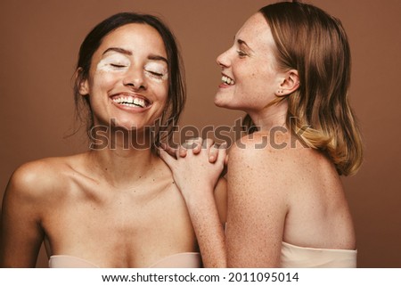 Portrait of two happy women with skin pigmentation together against brown background. Young women with vitiligo and freckles in cheerful mood. Royalty-Free Stock Photo #2011095014