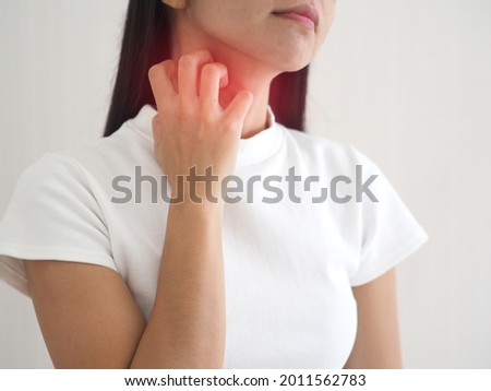 Asian woman scratching the itch on her neck with redness rash. cause of itchy skin include insect bites, dermatitis, fooddrugs allergies or dry skin. health care concept. closeup photo, blurred. Royalty-Free Stock Photo #2011562783