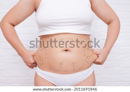 a plastic surgeon marks a woman's body for surgery to correct the figure. Royalty-Free Stock Photo #2011691846