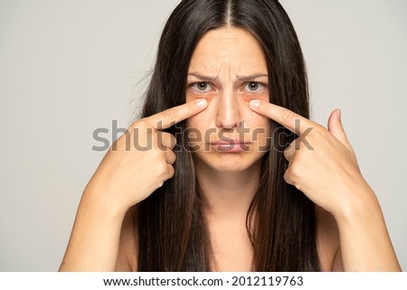 a young unhappy woman touches her undereyes on a gray background