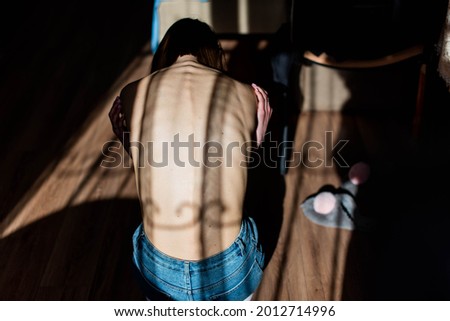 A girl with anorexia turned back, spine and ribs visible. Toned in cold tones for dramatic effect. Royalty-Free Stock Photo #2012714996