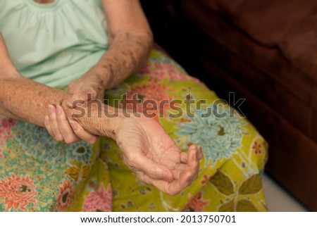 Old woman with symptoms Guillain-Barré syndrome (GBS) often pre