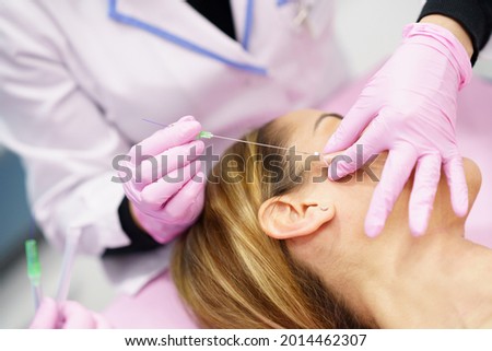 Doctor injecting PDO suture treatment threads into the face of a woman. Royalty-Free Stock Photo #2014462307