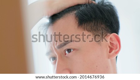 asian man worried for hair loss and looking at mirror his receding hairline Royalty-Free Stock Photo #2014676936