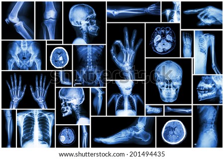 Collection X-ray multiple part of human Royalty-Free Stock Photo #201494435