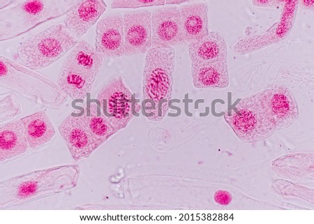 Mitosis cell in the Root tip of Onion under a microscope.
 Royalty-Free Stock Photo #2015382884