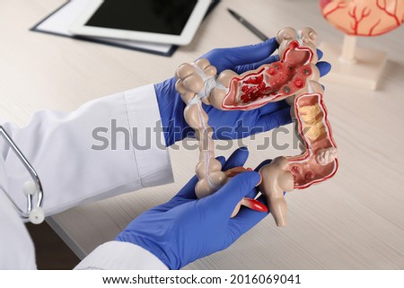 Gastroenterologist with human colon model at table, closeup Royalty-Free Stock Photo #2016069041