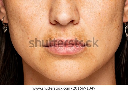 macro shot of a female face with dark skin on the upper lip Royalty-Free Stock Photo #2016691049