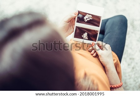 photo of a woman with ultrasound during pregnancy
