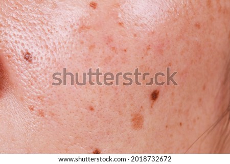 Close-up faces of girls It will reveal blemishes, freckles, dark spots, pores and uneven skin tone. Royalty-Free Stock Photo #2018732672