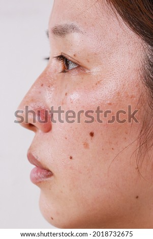 Close-up of a woman's face, half face, portrait with large pores black dots care for problem skin and white background Royalty-Free Stock Photo #2018732675