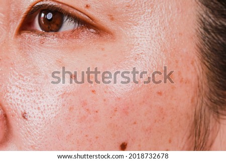 Skin care problems and health concepts Wrinkles, pores, freckles, dark spots, dry skin on the face, middle-aged women Royalty-Free Stock Photo #2018732678
