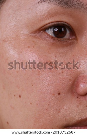 health concept Women skin care problems and wrinkles, pores, freckles, dark spots, dry skin on the face. Royalty-Free Stock Photo #2018732687