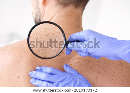 Dermatologist examining patient in clinic, closeup Royalty-Free Stock Photo #2019199172