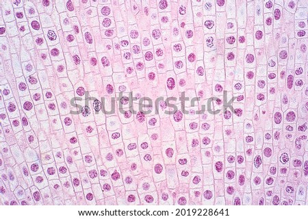 Mitosis cell of root tip of onion under the light microscope view. Royalty-Free Stock Photo #2019228641