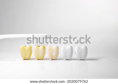 Discoloration teeth, Cure yellow teeth This can be done by starting with oral and dental care cleaning By brushing your teeth properly at least twice a day or brushing your teeth after every meal  Royalty-Free Stock Photo #2020079762