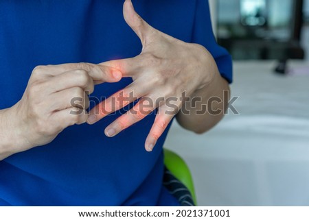 Overuse hand problems. Woman’s hand with red spot o fingers as suffer from Carpal tunnel syndrome. The symptoms of tingling, numbness, weakness, or pain of the fingers and wrist. 