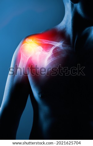 Human shoulder joint in x-ray on blue background