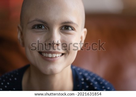 Close up portrait of happy hairless ill woman with cancer getting good result of chemotherapy. Oncology patient looking at camera, smiling on way to recovery and remission. Survivor in fight for life