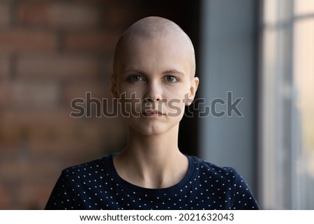 Young hairless cancer survivor head shot portrait, patient profile picture. Serious young woman with shaved head looking at camera. Oncology treatment, chemotherapy, hope and fight for life concept