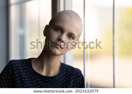 Head shot portrait of young millennial woman with shaved head suffering from oncological disease. Cancer patient taking chemotherapy, radiotherapy against leukemia, brain tumor, fighting for life