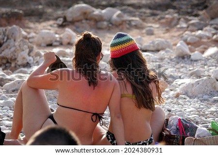 Two girls by the sea from behind with obvious burns to the skin