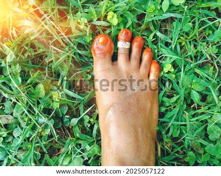 gorintaku applied married women foot. foot second longer than toe finger.