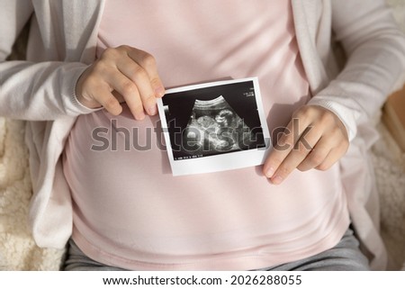 Expectant mother holding ultrasound scan at big tummy, showing picture at camera. Cropped shot of pregnant woman with sonogram image of unborn baby. Prenatal care, pregnancy, motherhood concept