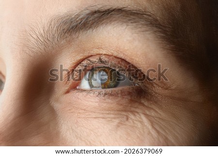 Closeup view of mature woman with cataract Royalty-Free Stock Photo #2026379069