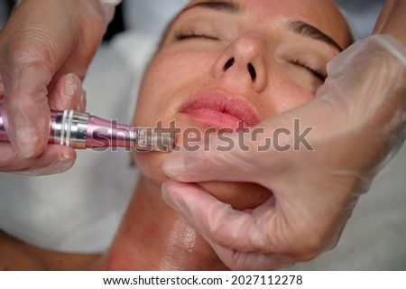 Cosmetician makes microneedling, care to the patient using dermapen Royalty-Free Stock Photo #2027112278