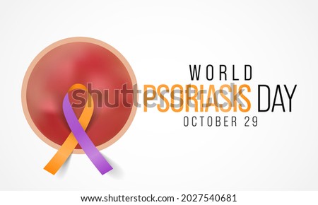 World Psoriasis day is observed every year on October 29, it is a skin condition that causes red, flaky, crusty patches of skin covered with silvery scales. Vector illustration
