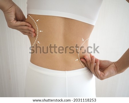 Female posing back side with drawing white arrows on her, lose weight and liposuction cellulite removal concept, on white background. closeup photo, blurred.