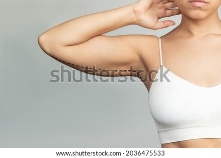 Cropped shot of a young woman with excess fat on her upper arm with marks for liposuction or plastic surgery isolated on a gray background. The loose and saggy muscles. Overweight Royalty-Free Stock Photo #2036475533