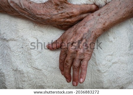 Closeup of old woman arms holding her painful wrist ...arthritis, osteoporosis, rheumatism concept. Numbness of the hand with deformity  trying to hold white pillow 