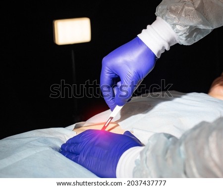 Doctor surgeon with a scalpel in his hand before bowel surgery in a patient, close-up. Small intestine part removal concept and bowel disease treatment Royalty-Free Stock Photo #2037437777