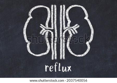 Chalk drawing of human kidneys and medical term reflux. Concept of learning medicine.