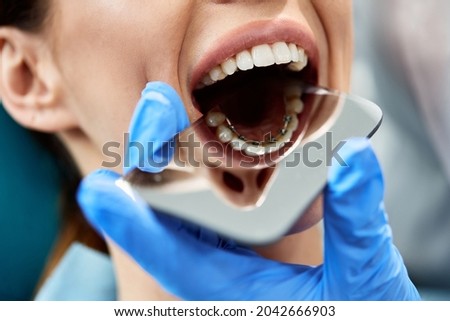 Close-up of dentist using mirror while checking dental braces on back side of patient's teeth at dentist's office. Royalty-Free Stock Photo #2042666903