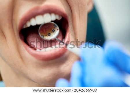Close-up of woman having lingual braces check-up by orthodontist during appointment at dental clinic. Royalty-Free Stock Photo #2042666909