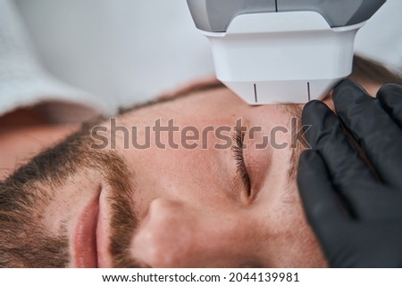 Young man undergoing the high-intensity focused ultrasound treatment Royalty-Free Stock Photo #2044139981