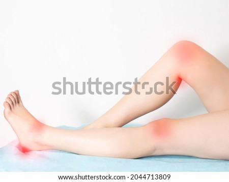 female legs on a white background with sore reddened knee joints and ankle joints with heels. Concept of disease and treatment of arthritis and joint inflammation. Royalty-Free Stock Photo #2044713809