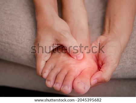 Closeup of female holding her painful feet and massaging her bunion toes to relieve pain. Swollen bunion at the edge of the big toe causes deformity (Hallux valgus). Woman's health concept. Royalty-Free Stock Photo #2045395682