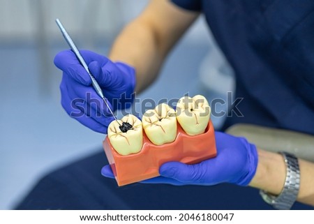 training, education, practicing dentist work. demonstration different stages caries on model on jaw for patient. mock of diseases teeth in dental clinic Royalty-Free Stock Photo #2046180047