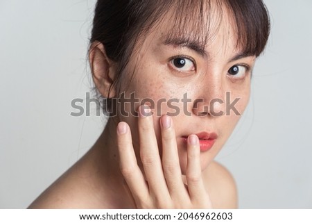 Young Asian woman worry with freckle on face and hand gently touching cheek applying skincare cosmetics treatment. Royalty-Free Stock Photo #2046962603