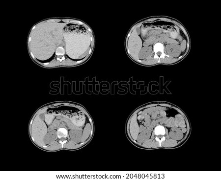 Professional and unique abdomen x-ray images