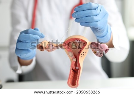 Gynecologist shows how to ligate the fallopian tubes on training model of female reproductive system Royalty-Free Stock Photo #2050638266