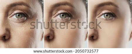 Comparison of female face after incredible rejuvenation process or heavy retouching Royalty-Free Stock Photo #2050732577