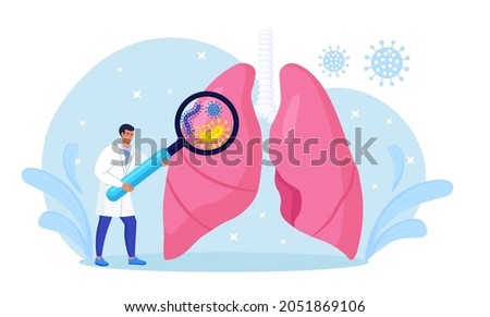 Pulmonology. Tiny doctor examining lungs with magnifier. Tuberculosis, pneumonia, lung cancer treatment or diagnostic. Internal organ inspection for respiratory system illness, disease or problems Royalty-Free Stock Photo #2051869106
