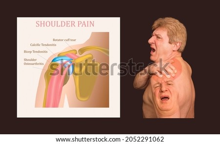 Shoulder joint structure and shoulder tendonitis. The collage of senior man with shoulder pain over black background. Healthcare concept Royalty-Free Stock Photo #2052291062