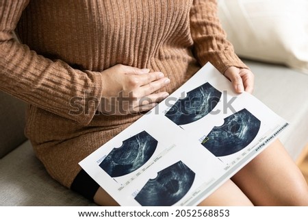 Hand of woman holding ultrasound image test report from the examination,female has a stomachache,check about abdominal pain or uterus disease,uterine cysts or pregnancy problems or cancer,health care Royalty-Free Stock Photo #2052568853